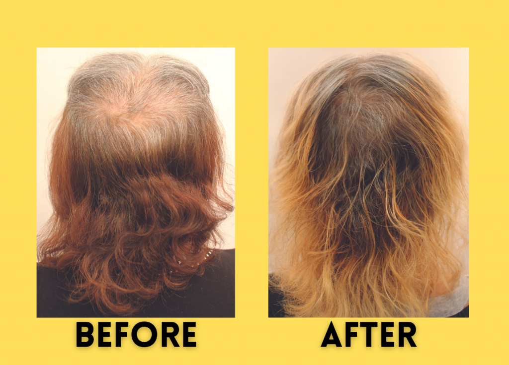 Ana Before and After Results of UGRO GASHEE Hair Health Topicals infused with Olive Leaf Extract.
