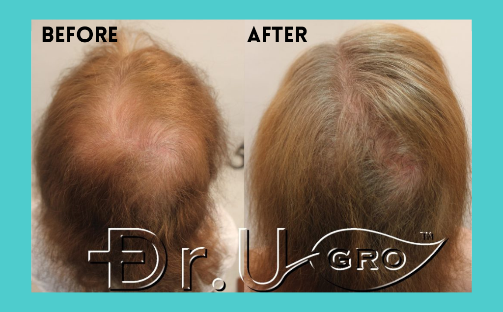 olive oil for hair before and after