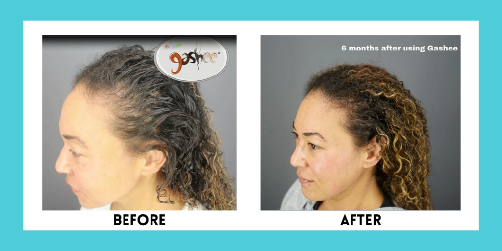 Jennifer before and after results using GASHEE all-natural hair growth products.