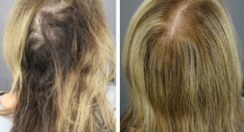 GASHEE Hair Stories: A Powerful Hair Story to Remember