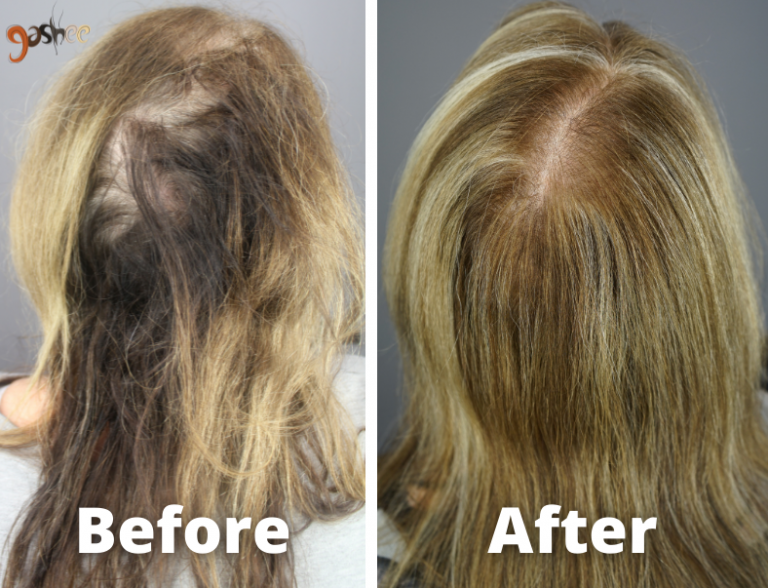 Before and After Dr.UGRO GASHEE Results - Natural Hair Growth Solution. Oral Supplement, Topical Lotion Hair Results.