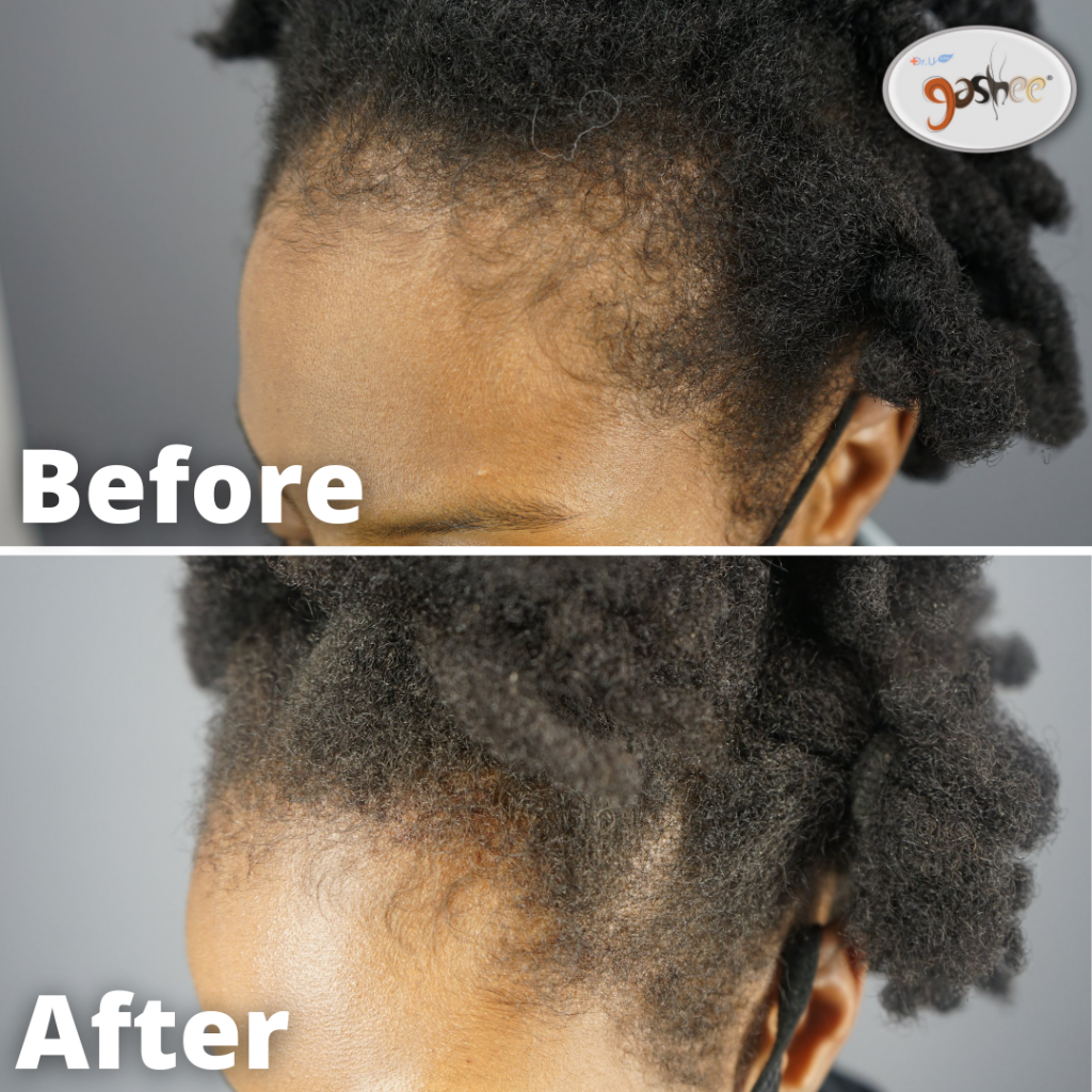 natural hair growth before and after