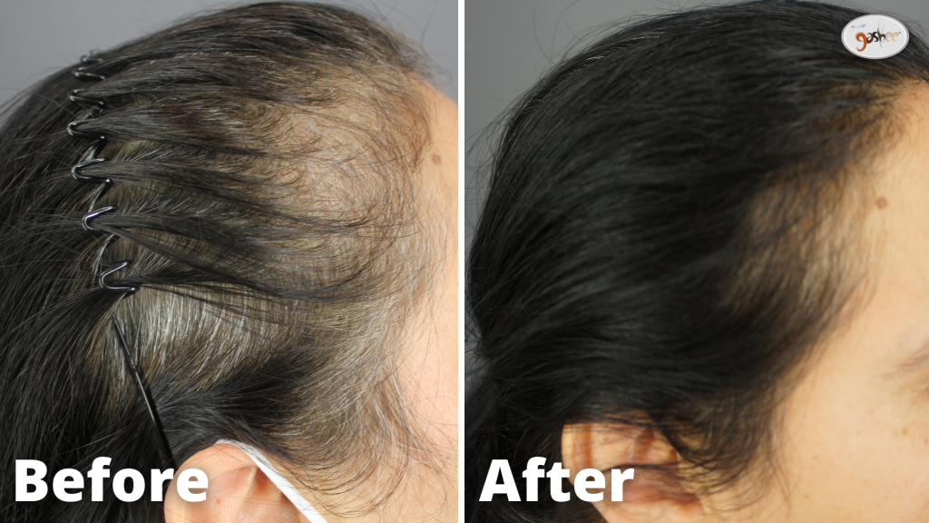 GASHEE Before and After Results - Oral & Topical Lotion Natural Hair Growth Results.